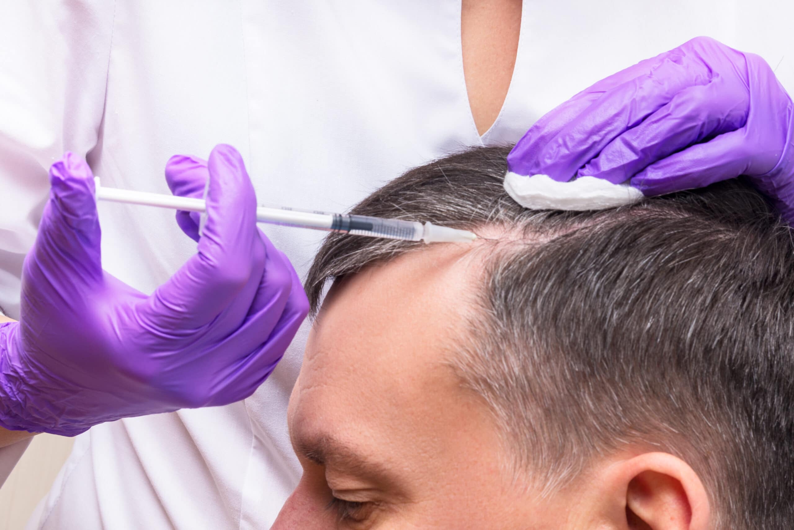 Hair Treatment